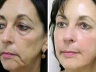 :   , Instantly Ageless        ,      